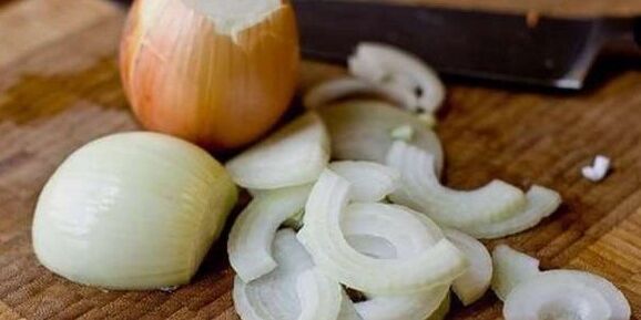 Cebula