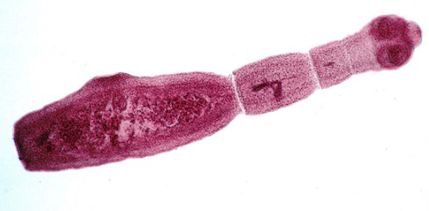 Echinokok